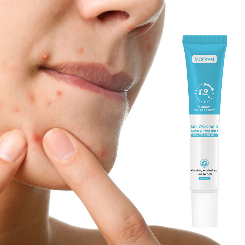 Hot Sale Effective Salicylic Acid Salvia Miltiorrhiza Acne Removal Gel Unclog Pores Deeply Cleaning 20g MOOYAM Acne Removal Gel